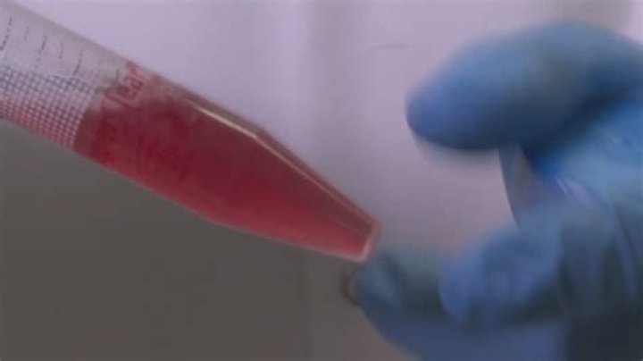 What happens to your blood in zero gravity?
