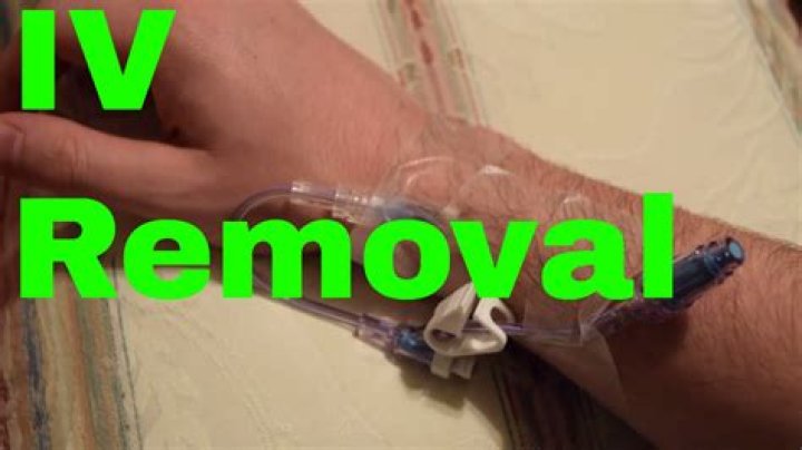 What happens when you pull an IV out?