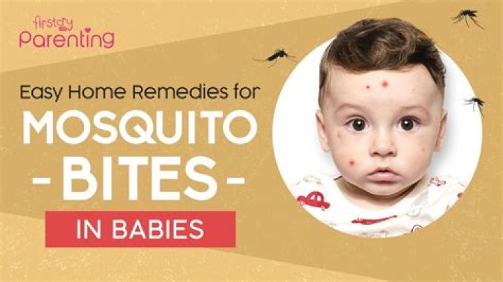 What helps bug bites on babies face?