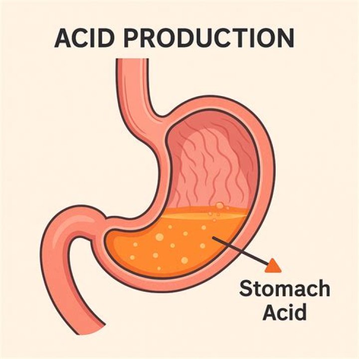 What ion is a component of stomach acid?