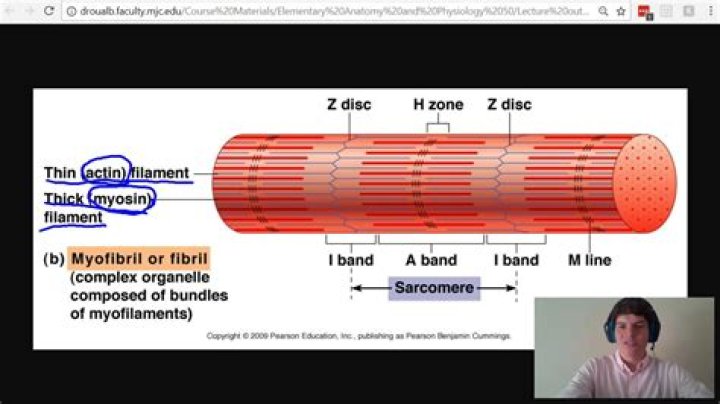 What is a Band 1 cable?