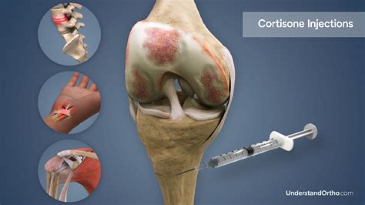 What is a cortisone shot made of?