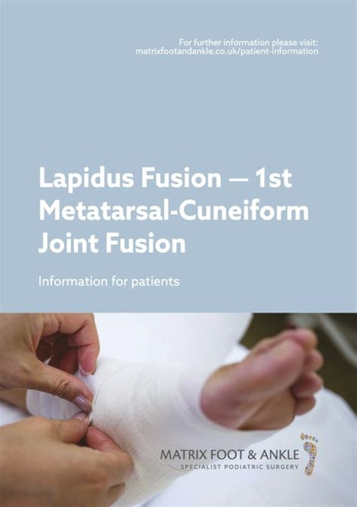 What is a Lapidus fusion?