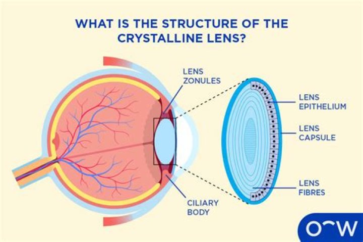 What is a lens assembly?