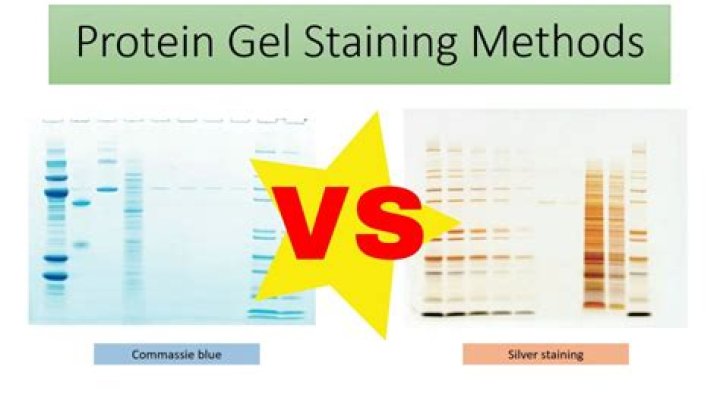 What is a protein standard and why do we load it on your gels?