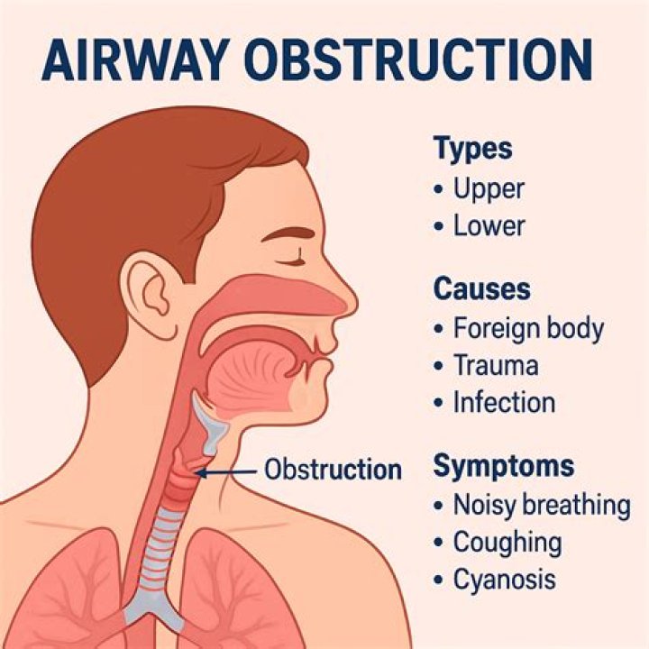 What is airway thickening?