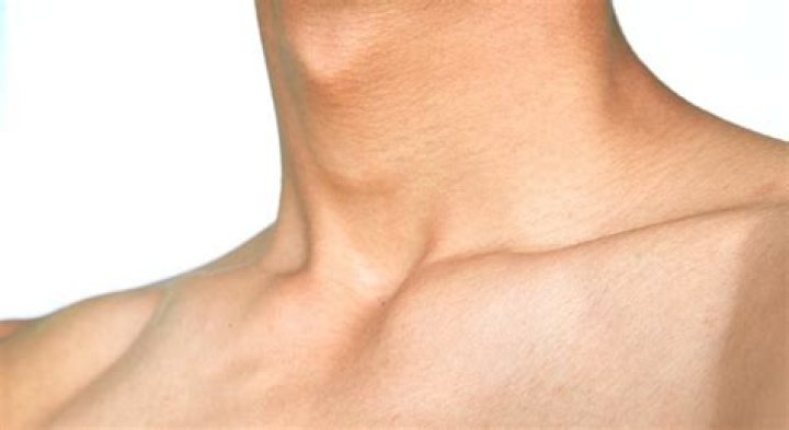 What is another name for your Adam's apple?