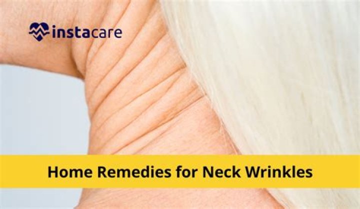 What is best treatment for neck wrinkles?