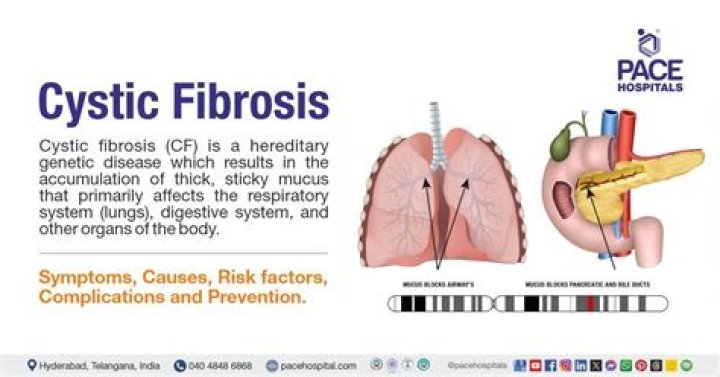 What is CF SSH?