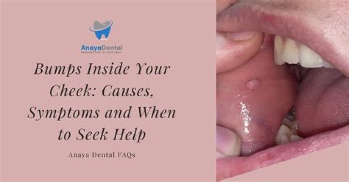 What is inner cheek?