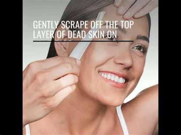 What is it called when they scrape dead skin off your face?