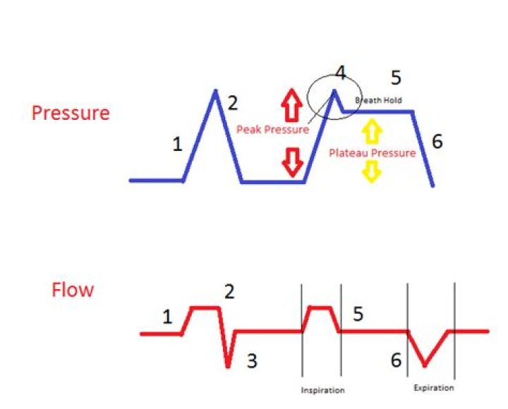 What is peak pressure in engine?