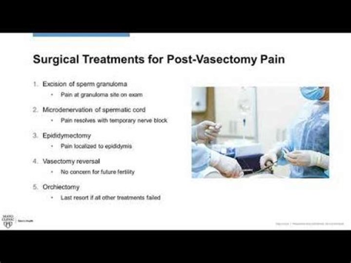 What is post-vasectomy pain syndrome?