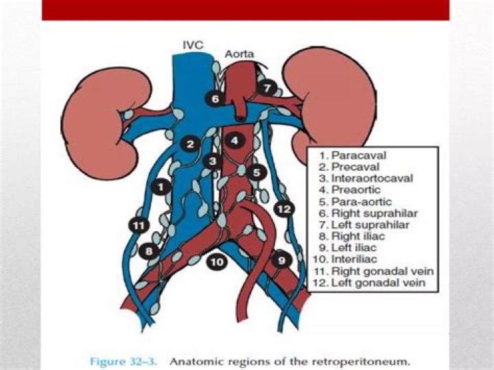 What is prominent retroperitoneal lymph nodes?