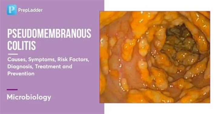 What is Pseudomembrane?