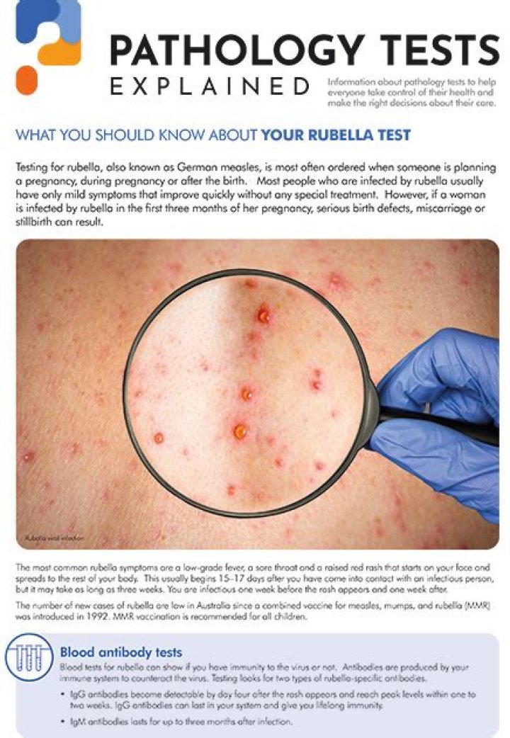 What is rubella avidity test?
