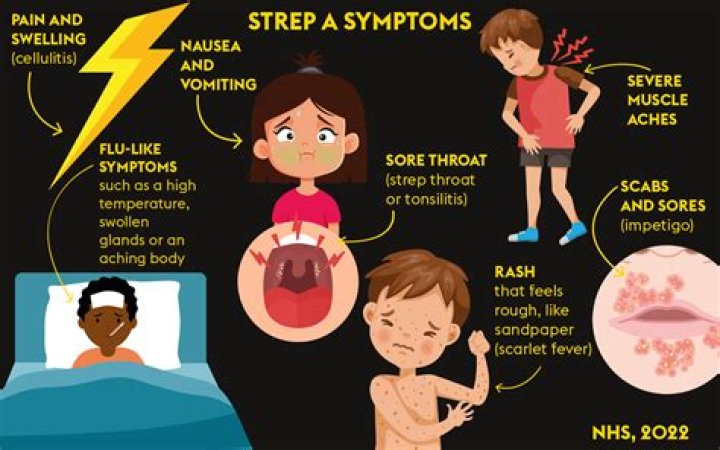 What is strep A in pregnancy?