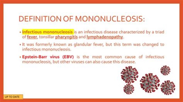 What is the common name for infectious mononucleosis?