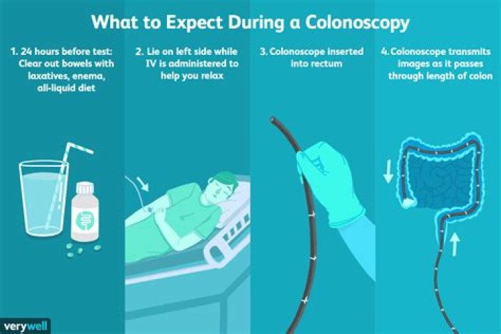 What is the cost of colonoscopy test?