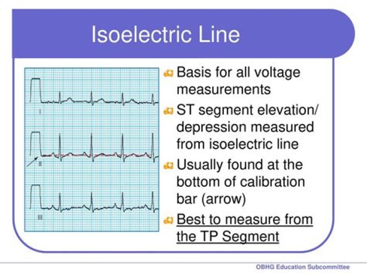 What is the isoelectric lead?