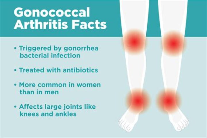 What is the meaning of gonococcal infection?