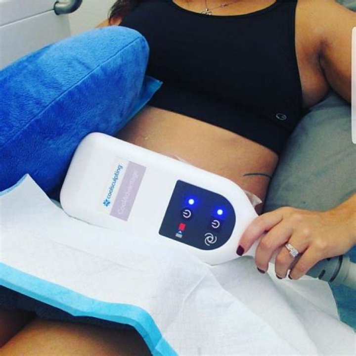 What is the most effective alternative to liposuction?