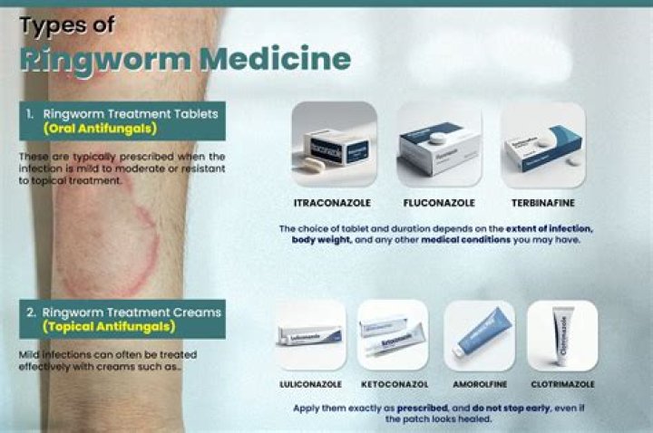 What is the most effective medicine for ringworm?