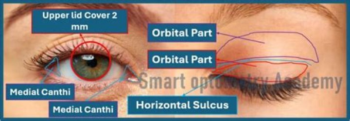 What is the open space between the eyelids called?