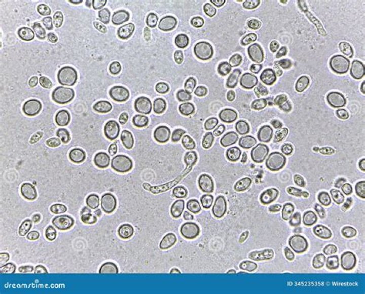 What is the range of protein content in yeast cells?