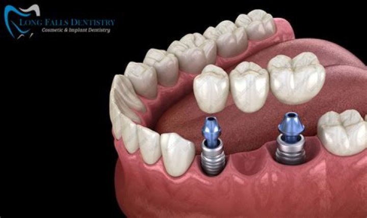 What is the term abatement?