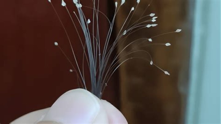 What is the white ball at the end of hair?