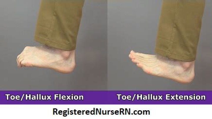 What is toe extension?
