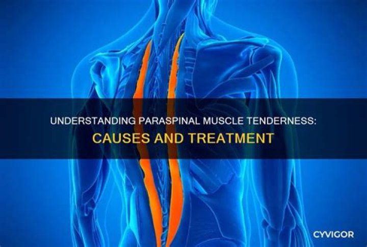What means pain or tenderness in the muscle?