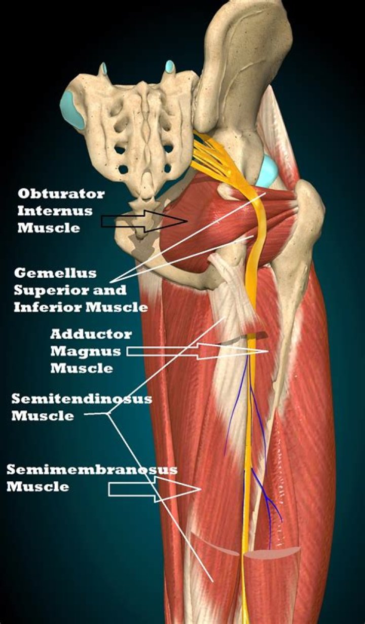 What muscles are involved in sciatica?