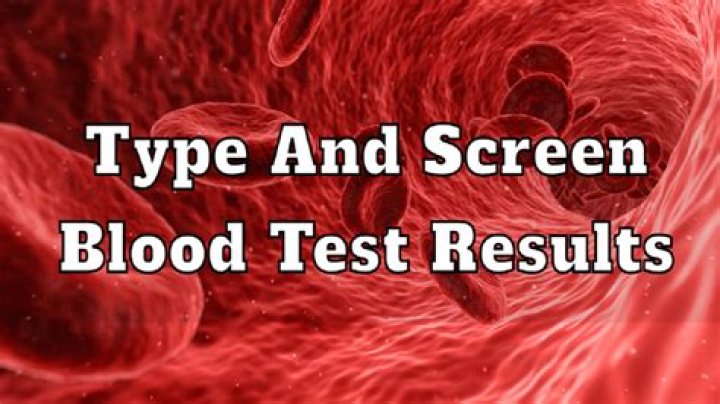 What other testing is done for a type and screen?