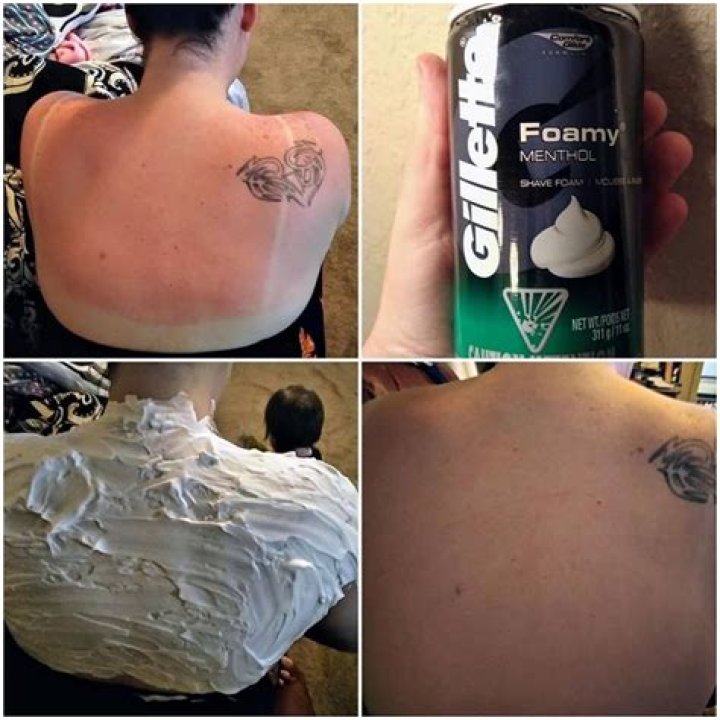 What shaving foam is best for sunburn?