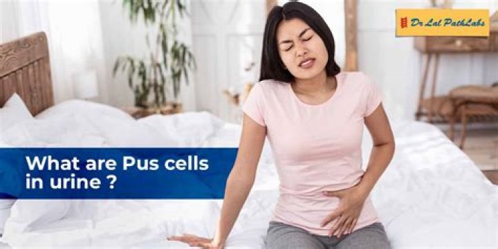 What should be the normal pus cells in urine?