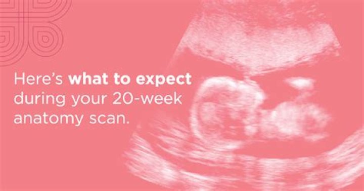 What should I feel at 20 weeks pregnant?