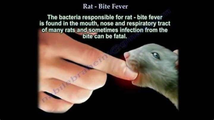 What should we do after rat bite?