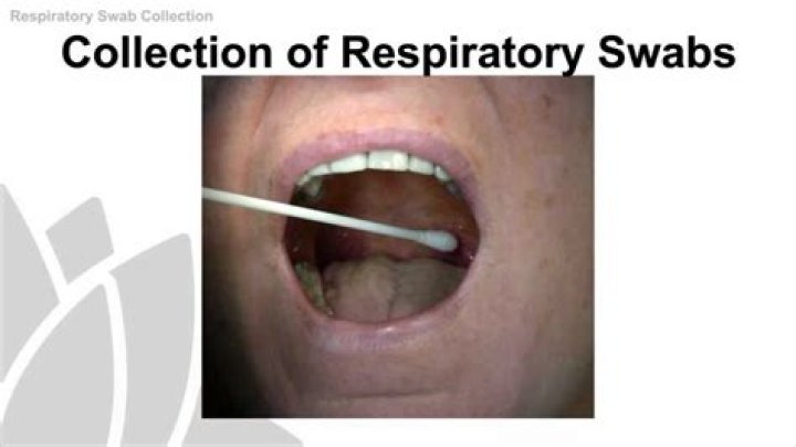 What swab means?
