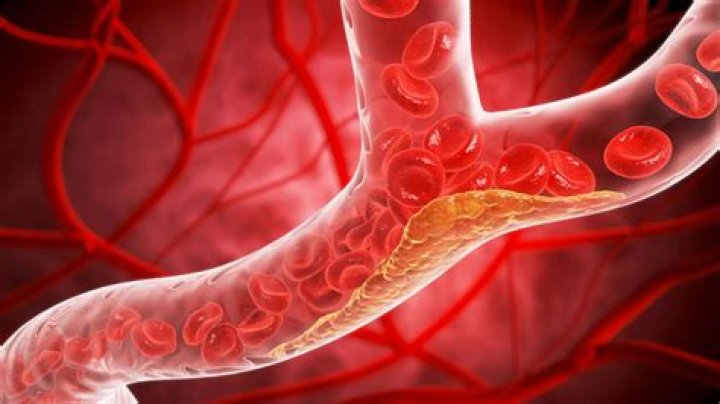 What term means blood disease?