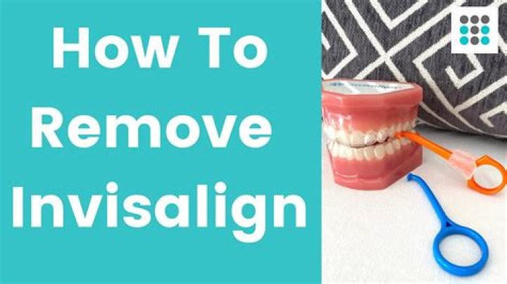 When can you take off Invisalign?