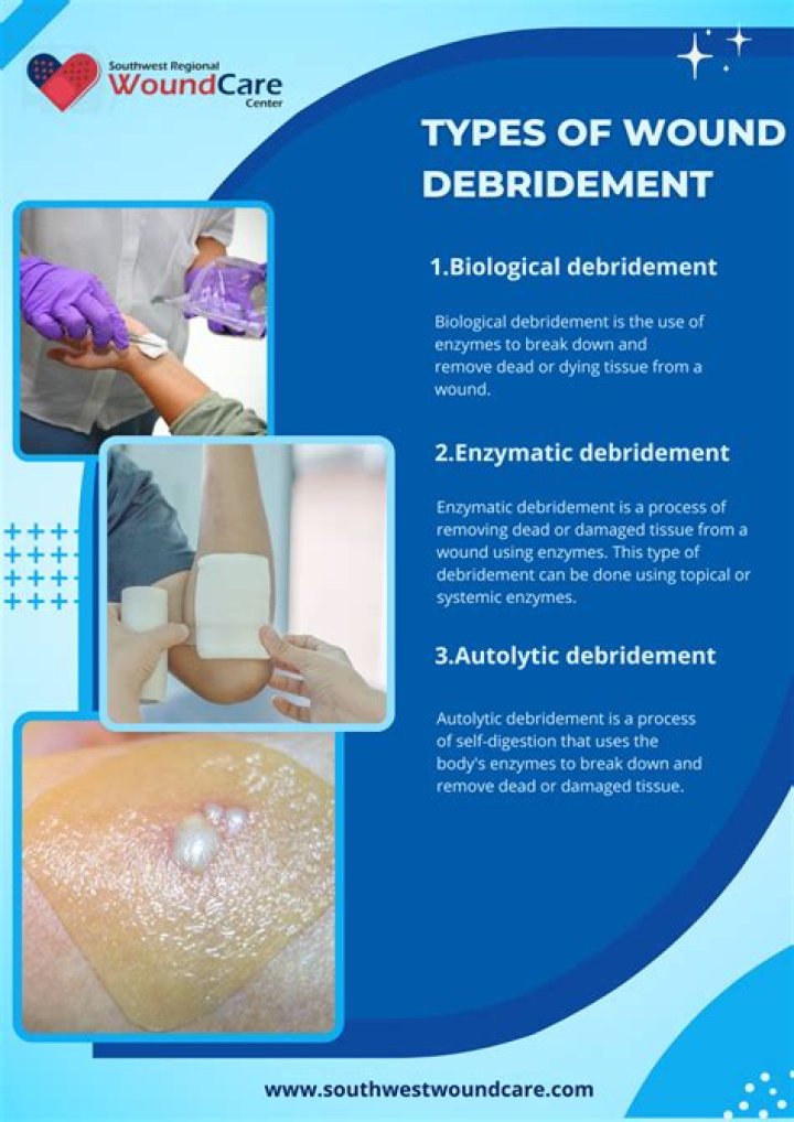 When does a burn need debridement?