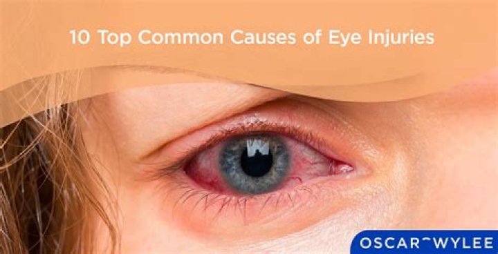 Where do most eye injuries occur?