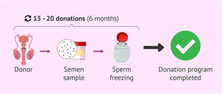 Where do you buy sperm?