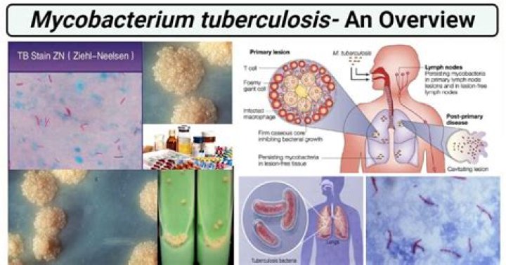 Where is M tuberculosis found?