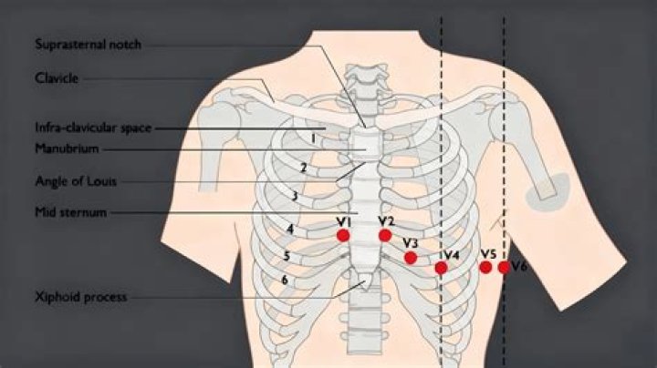 Where is V1 located ECG?