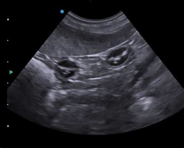 Which animals can detect ultrasound?