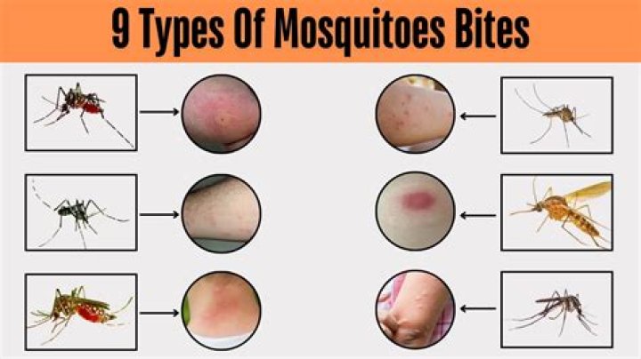 Which mosquito bite causes dengue fever?