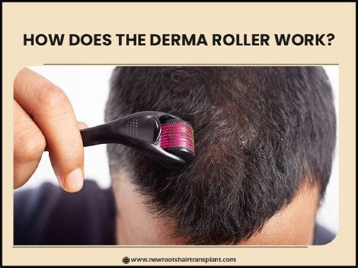 Which oil is best after dermaroller?